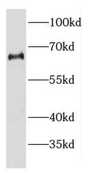 DDX56 Rabbit Polyclonal Antibody