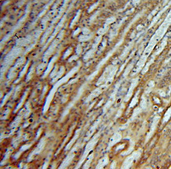 DEAF1 Rabbit Polyclonal Antibody