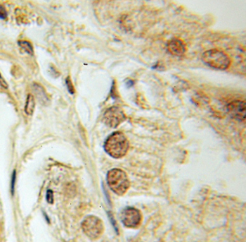 DEDD Rabbit Polyclonal Antibody