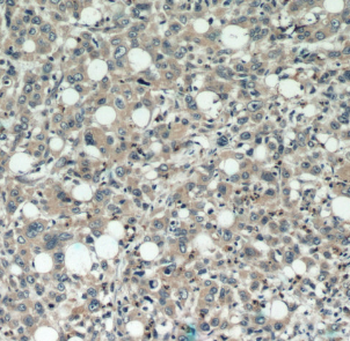 DEFB121 Rabbit Polyclonal Antibody