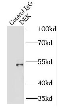 DEK Rabbit Polyclonal Antibody