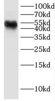 DEK Rabbit Polyclonal Antibody