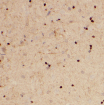DEK Rabbit Polyclonal Antibody