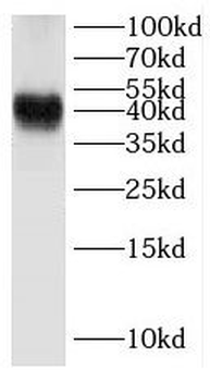 DMTN Rabbit Polyclonal Antibody