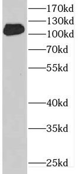 DENND1A Rabbit Polyclonal Antibody