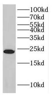 DPT Rabbit Polyclonal Antibody