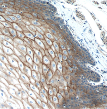 DSC2 Rabbit Polyclonal Antibody