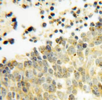 DEXI Rabbit Polyclonal Antibody