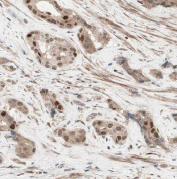 DFFA Rabbit Polyclonal Antibody