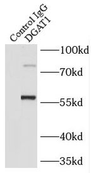 DGAT1 Rabbit Polyclonal Antibody