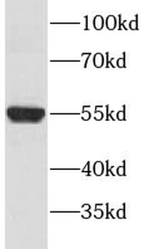 DGAT1 Rabbit Polyclonal Antibody