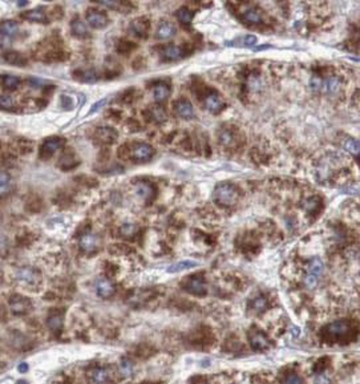 DGAT1 Rabbit Polyclonal Antibody