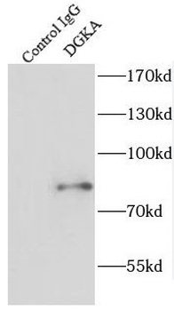 DGKA Rabbit Polyclonal Antibody