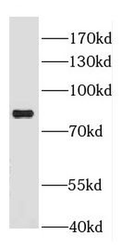 DGKA Rabbit Polyclonal Antibody