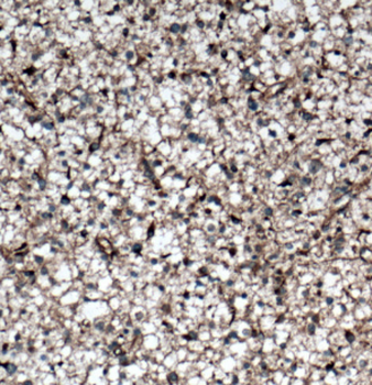 DGKA Rabbit Polyclonal Antibody