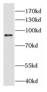 DGKB Rabbit Polyclonal Antibody