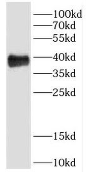 DHDH Rabbit Polyclonal Antibody
