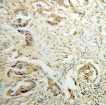 DHDH Rabbit Polyclonal Antibody