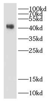 DHH Rabbit Polyclonal Antibody
