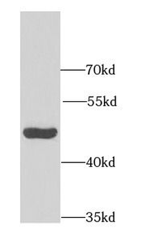 DHODH Antibody