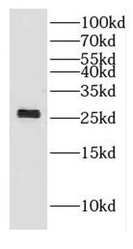 DHRS11 Rabbit Polyclonal Antibody