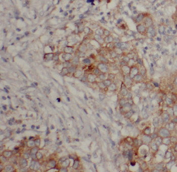 DHRS11 Rabbit Polyclonal Antibody