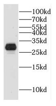 DHRS2 Rabbit Polyclonal Antibody