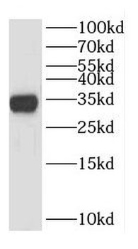 DHRS4 Rabbit Polyclonal Antibody