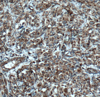 DHRS4 Rabbit Polyclonal Antibody