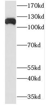 DHX16 Rabbit Polyclonal Antibody