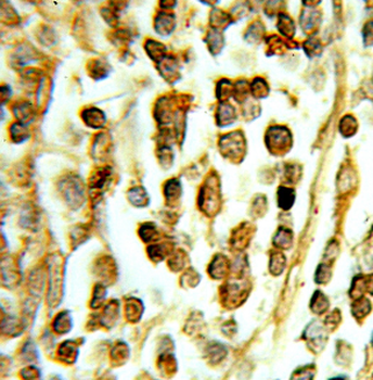 DHX16 Rabbit Polyclonal Antibody