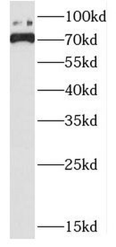 DHX32 Rabbit Polyclonal Antibody