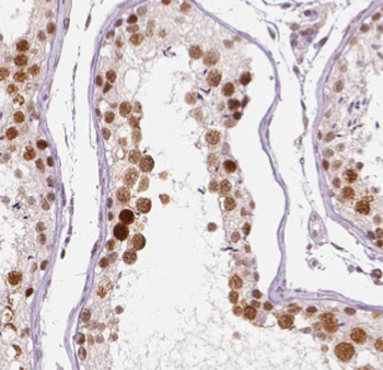 DHX32 Rabbit Polyclonal Antibody