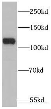 DHX36 Rabbit Polyclonal Antibody