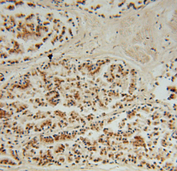DHX36 Rabbit Polyclonal Antibody