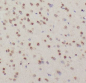 DHX9 Antibody
