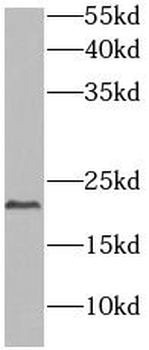 DIABLO Rabbit Polyclonal Antibody