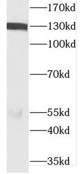 DIAPH3 Rabbit Polyclonal Antibody