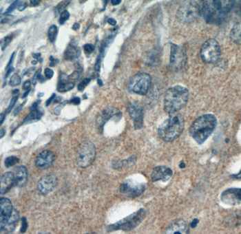 DIAPH3 Rabbit Polyclonal Antibody