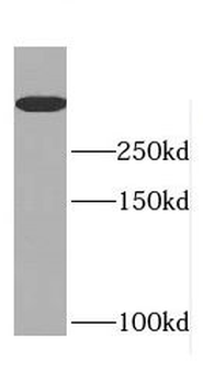 DIDO1 Rabbit Polyclonal Antibody