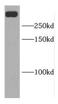 DIDO1 Rabbit Polyclonal Antibody