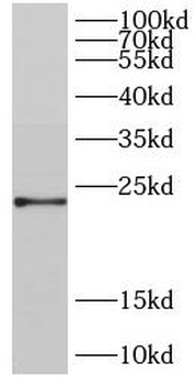 DIRAS2 Rabbit Polyclonal Antibody