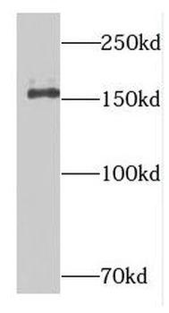 DISP1 Rabbit Polyclonal Antibody