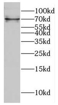DIXDC1 Rabbit Polyclonal Antibody