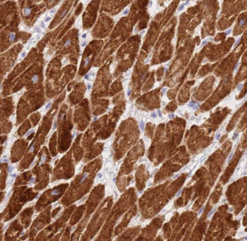 DIXDC1 Rabbit Polyclonal Antibody