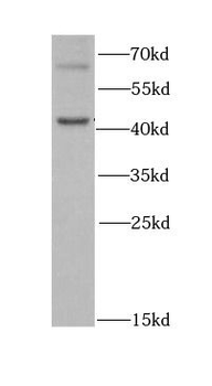 DKC1 Rabbit Polyclonal Antibody