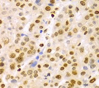 DKC1 Rabbit Polyclonal Antibody