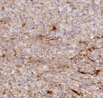 DKK1 Rabbit Polyclonal Antibody