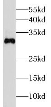 DKK2 Rabbit Polyclonal Antibody