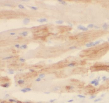 DKK2 Rabbit Polyclonal Antibody